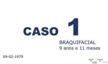 Caso 01 - IRB Ortodontia