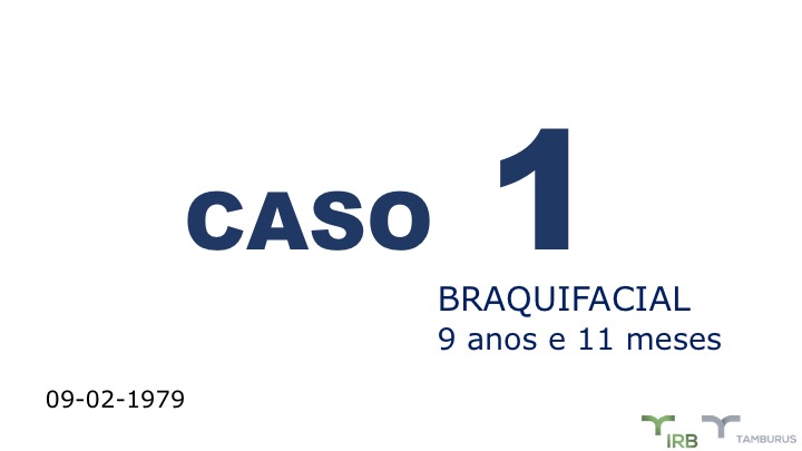 Caso 01 - IRB Ortodontia