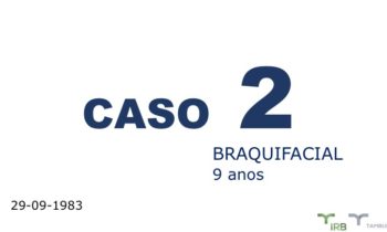 Caso 02 - IRB Ortodontia