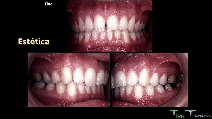 Caso 02 - IRB Ortodontia