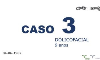 Caso 03 - IRB Ortodontia