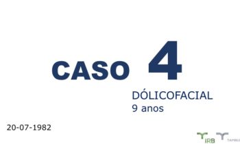 Caso 04 - IRB Ortodontia