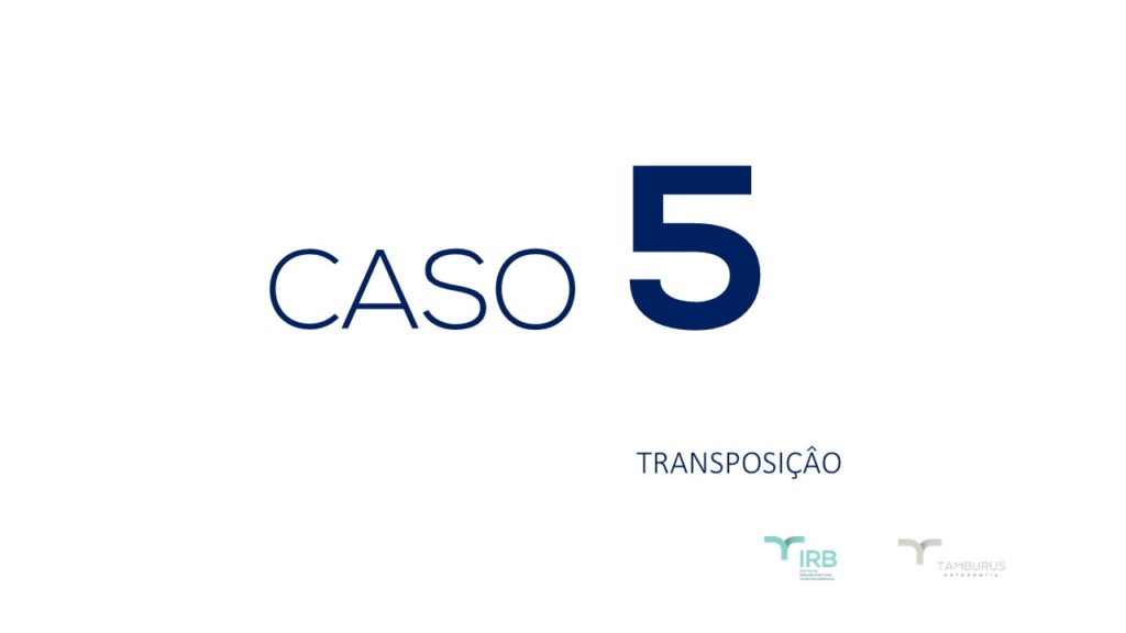 Caso 5 - Transposição IRB