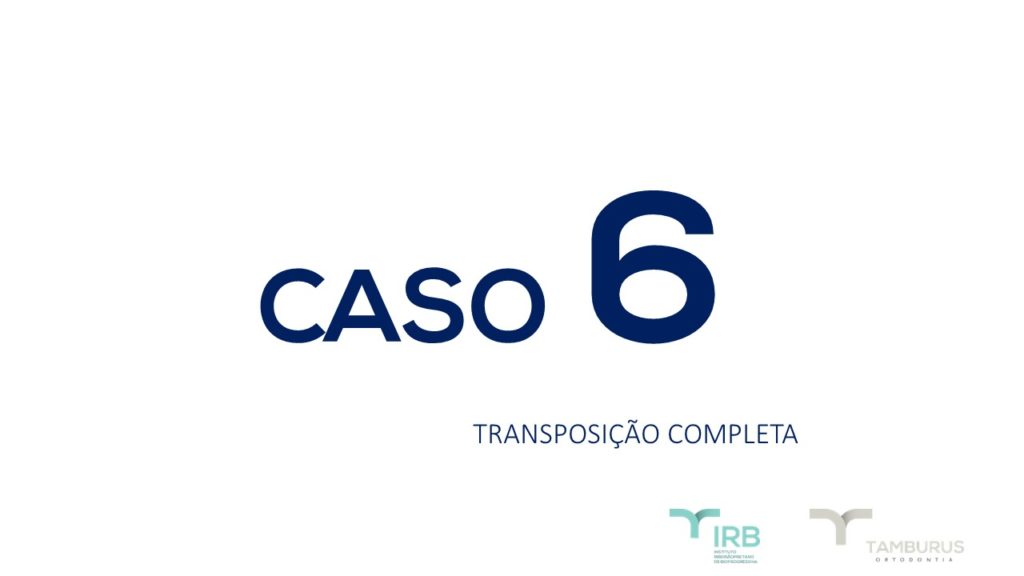 Caso 6 - Transposição Completa IRB