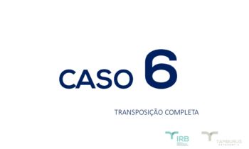 Caso 6 - Transposição Completa IRB