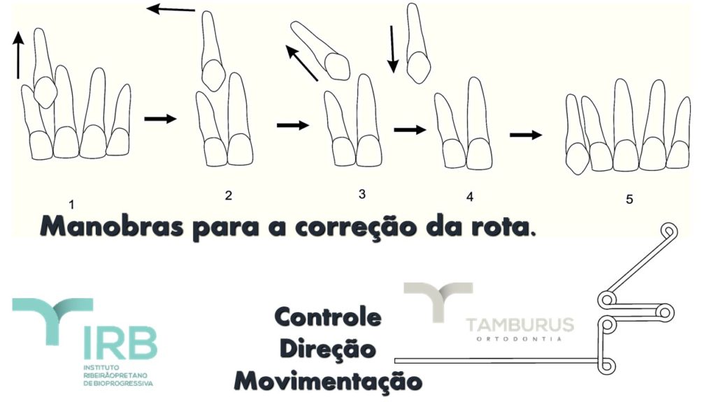 Caso 6 - Transposição Completa IRB