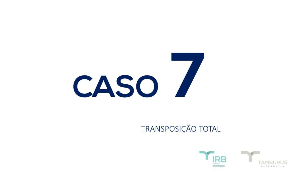 Caso 7 - Transposição Total IRB