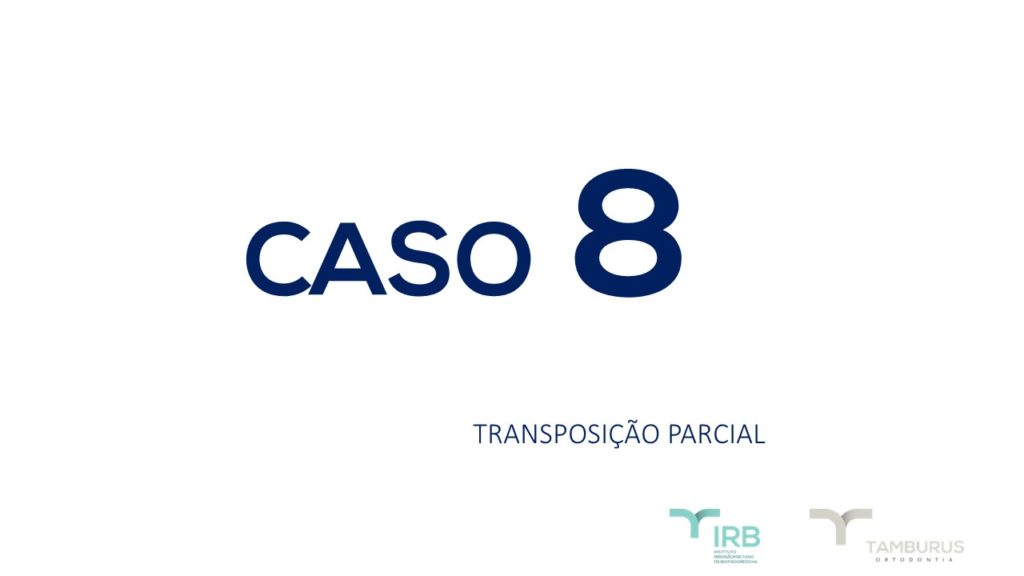 Caso 8 - Transposição Parcial IRB