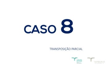 Caso 8 - Transposição Parcial IRB