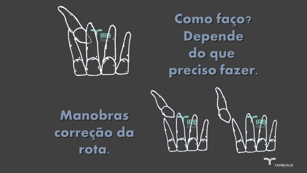 Caso 5 - Transposição IRB