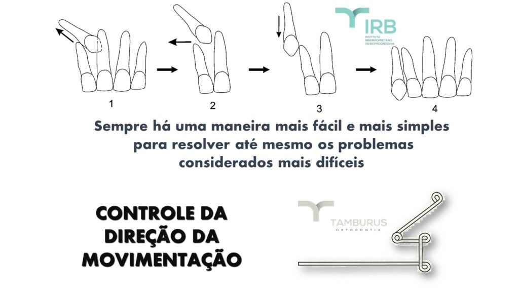 Caso 5 - Transposição IRB