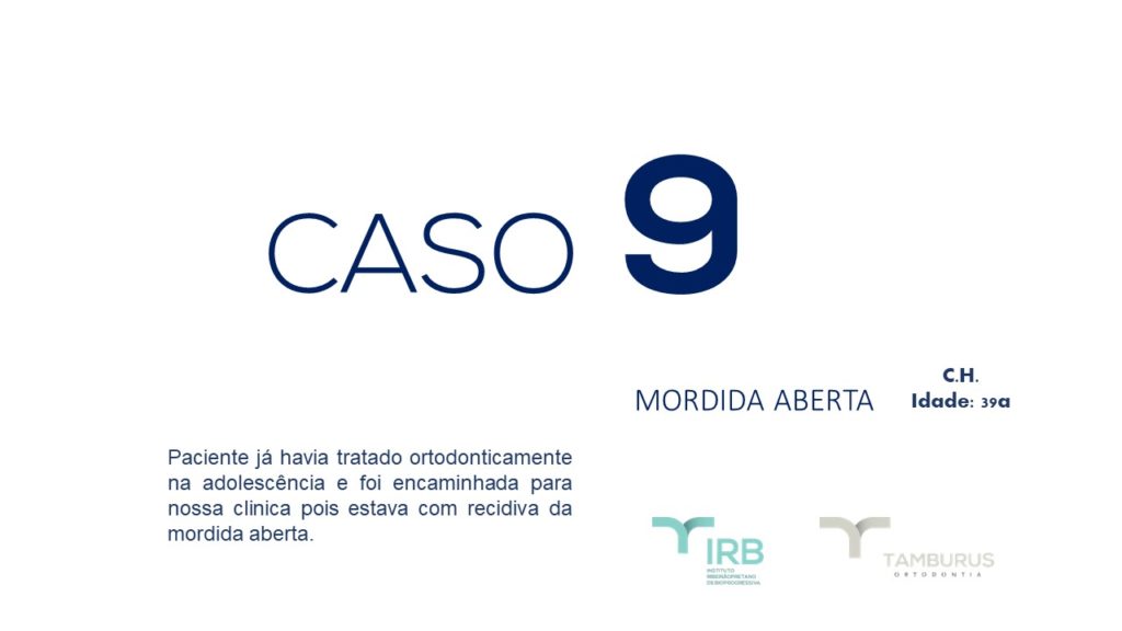 Caso 9 - Mordida Aberta - IRB