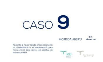 Caso 9 - Mordida Aberta - IRB