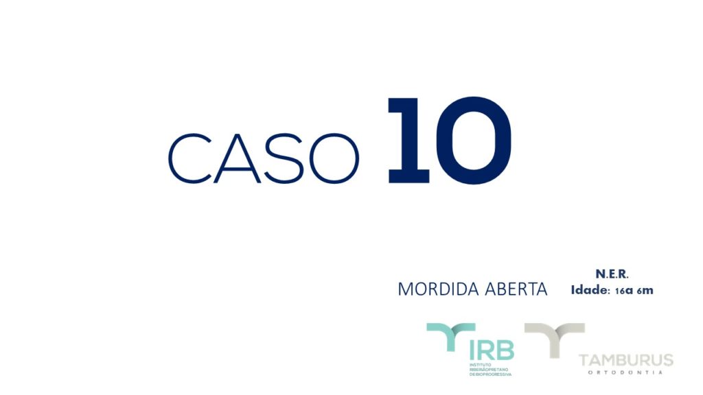 Caso 10 - Mordida Aberta - IRB