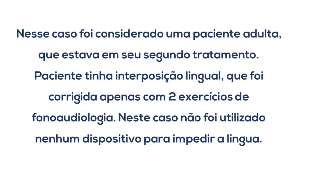 Caso 9 - Mordida Aberta - IRB