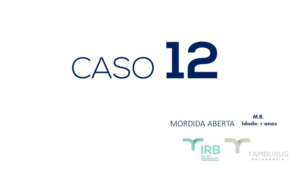 Caso 12 - Mordida Aberta - IRB