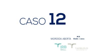 Caso 12 - Mordida Aberta - IRB
